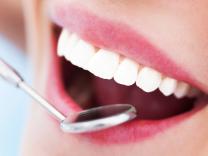 7 stvari koje Vam zubi pokušavaju saopštiti